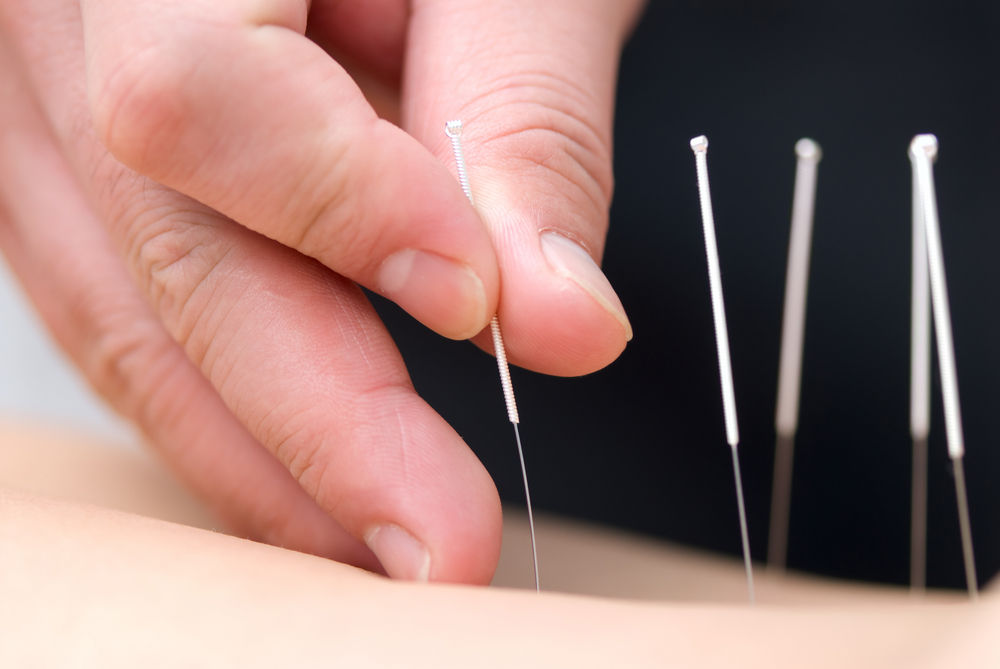 acupuncture pays basque